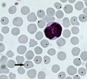 Diagnostika ochorenia